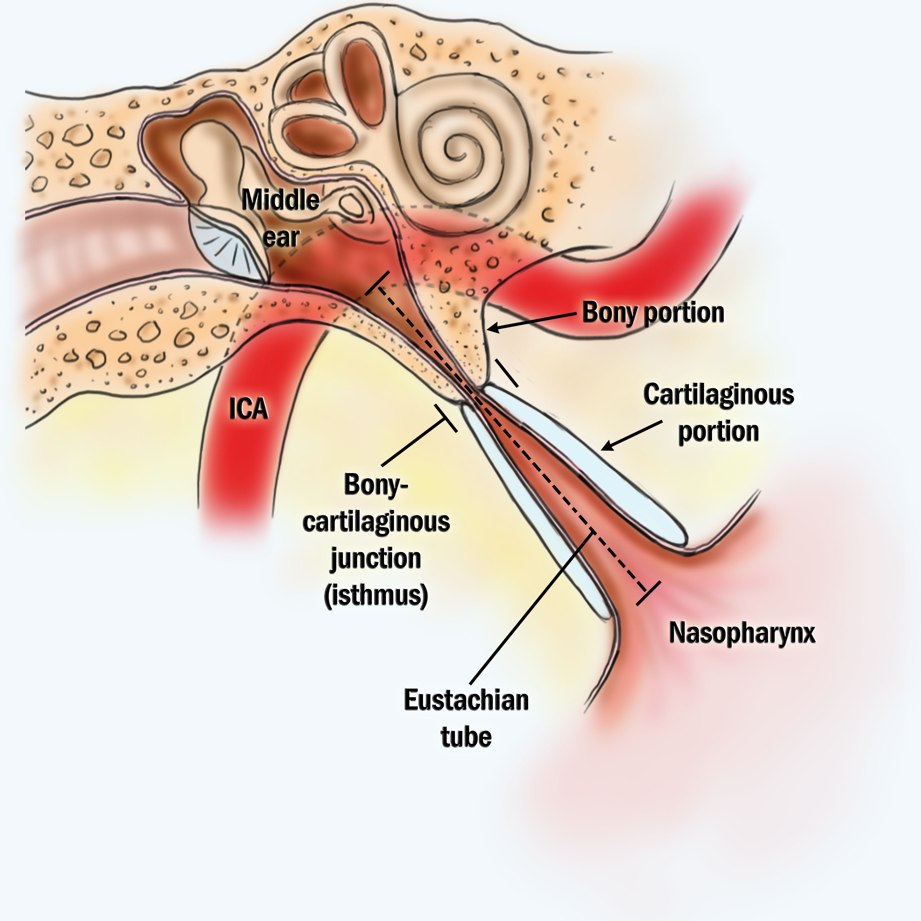 Best Nasal Spray For Eustachian Tube Dysfunction Uk