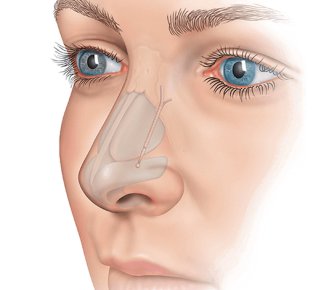 north-atlanta-ear-nose-throat-doctors-cumming-spirox-latera